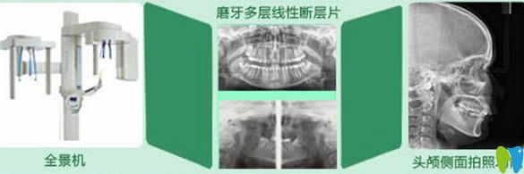 廈門峰煜口腔全套化的高端牙齒診療設(shè)備