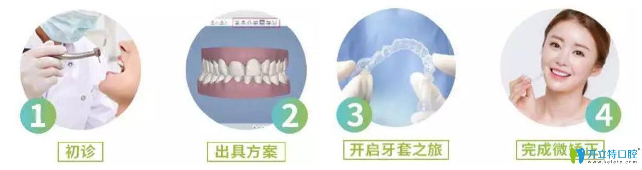 英博口腔隱形微矯怎么樣