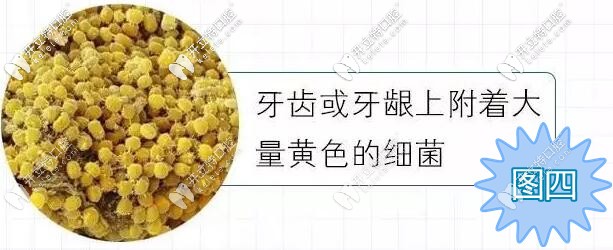 牙齒和牙齦上的細菌