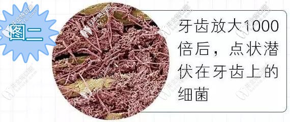 牙齒放大1千倍上面的細菌