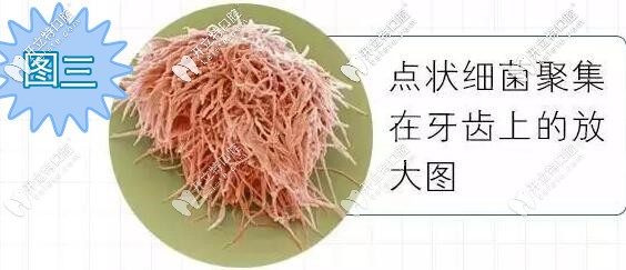 牙齒放大后上面的點狀細菌