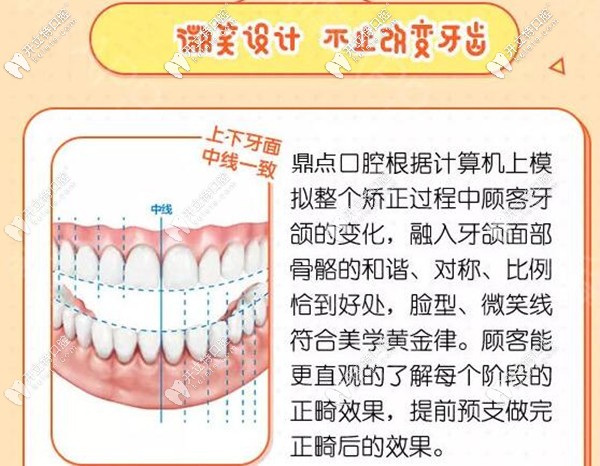 ?？诙c口腔牙齒矯正微笑設(shè)計