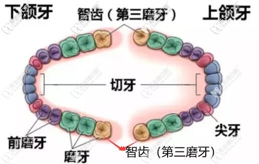 多生牙和智齒大有區(qū)別,是否要拔除兒童成人處理方式不同