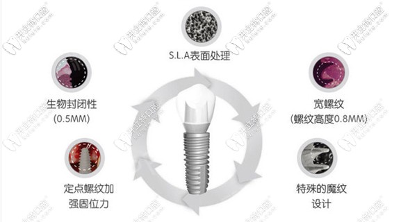 上海曙康口腔種植牙價格表公布,來看曙康種植牙多少錢一顆?