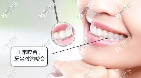 正常的牙齒咬合示意圖