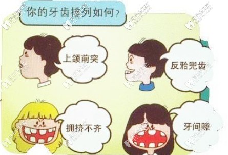 記錄3歲孩子佩戴羅慕兒童早期矯正器過程，真有必要矯正哦